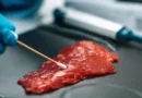 Brote de fiebre tifoidea en Ciudadela